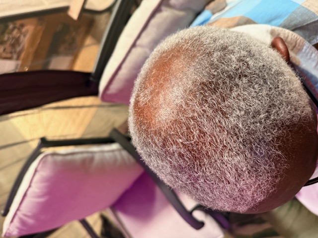 July 27, 2025 - 23 days of the 1DL oil & spray moisturizing regimen