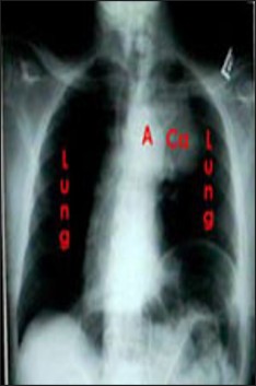 Asbestos Still Kills Podcast's image