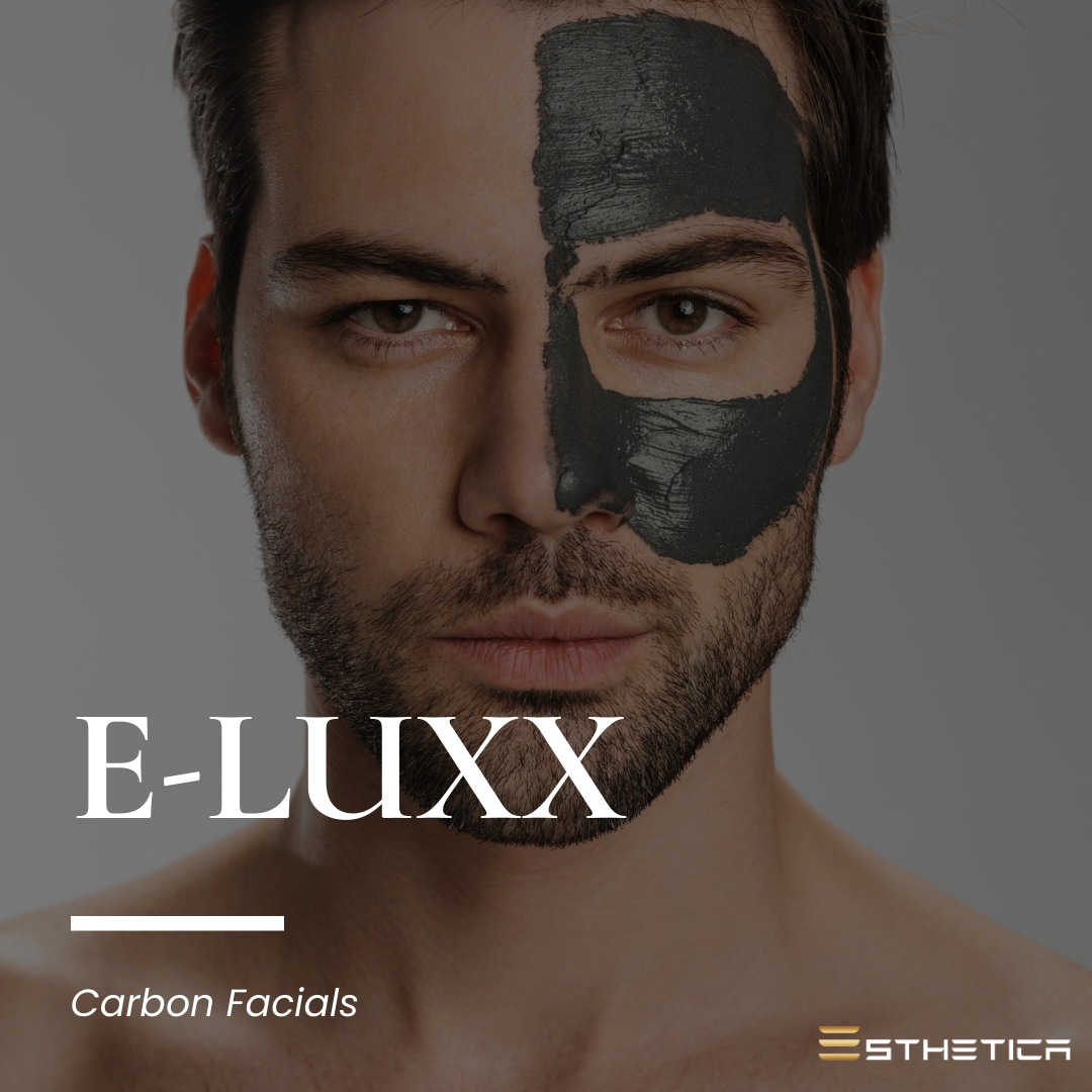 What are Carbon Laser Facials
