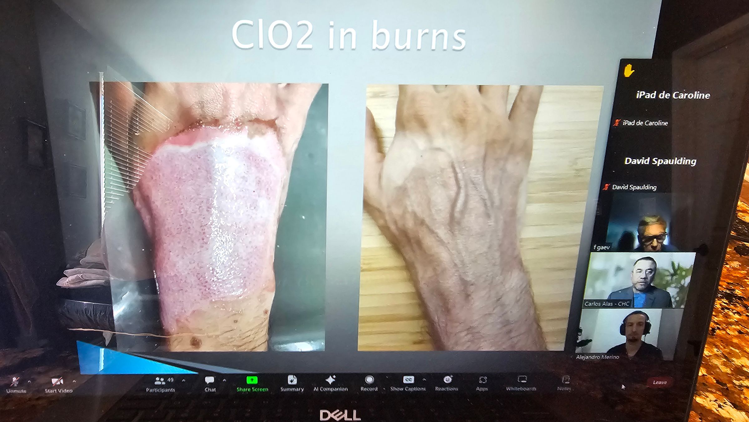 Healing after 3 months of using CDS/DMSO